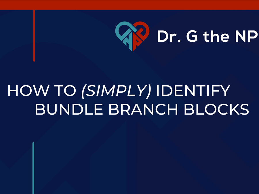 How to Identify bundle branch blocks